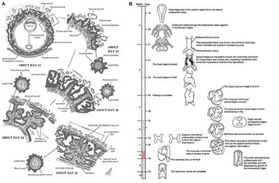 The Role of Abnormal Placentation in Congenital Heart Disease; Cause, Correlate, or Consequence?